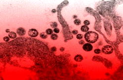Nigeria on edge over growing Lassa fever deaths