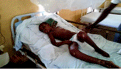 8-yr-old Chinaemerem  needs N1.3m to stay alive