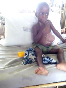‘Boy, 3, who drank acid, abandoned in LUTH’