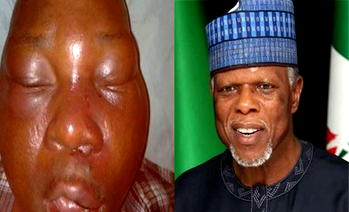Hearing on assault on Lagos journalist for March 16