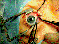 ‘Only 800 optometrists are engaged in public sector’