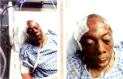 M-I-R-A-C-L-E: Obienu survives two brain surgeries, tells his chilling story