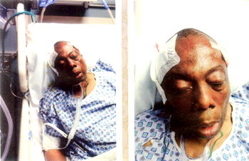 M-I-R-A-C-L-E: Obienu survives two brain surgeries, tells his chilling story