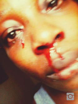 Battered by younger brother, Nollywood actress condemns domestic violence