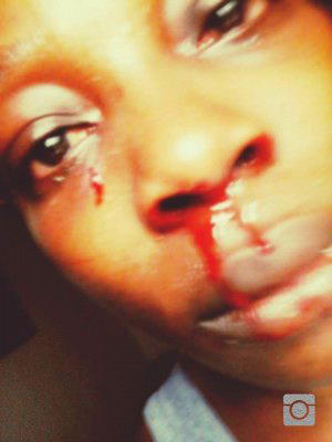 Battered by younger brother, Nollywood actress condemns domestic violence