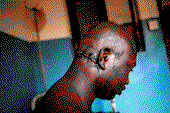 How Fulani herdsmen cut my head with machete – Oneyebuchie