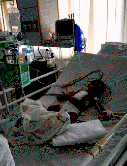 Child surgery neglected — Paediatrics surgeon
