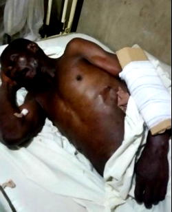 Killer herdsmen invade Ekiti  community, kill two, injure several