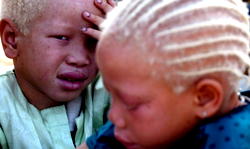 Killing spree of albinos fuelled by ritual practices and policing failures