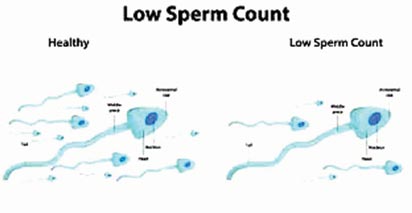 FERTILITY ALERT: Your sperm may no longer be viable