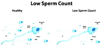 FERTILITY ALERT: Your sperm may no longer be viable