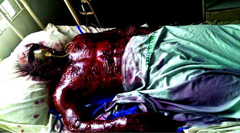 Nollywood actor gets burnt on set!