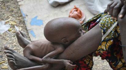 34,000 children malnourished in Zamfara