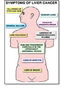 How to protect your liver from developing cancer