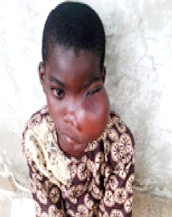 Agony of boy with a‘strange’  swollen jaw