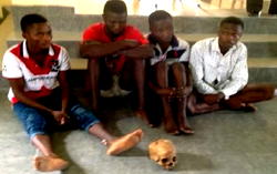 4 teenagers arrested over sale of human skull