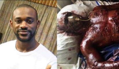 All truths about actor, Ani Iyoho who got burnt on set