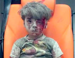 Syria Conflict: Outrage trails striking photo of injured boy