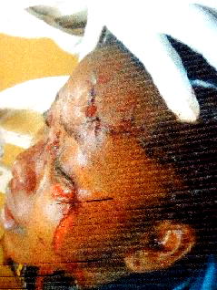 Salesgirl brutalised over over N400 fried meat