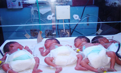 Premature baby in store incubator