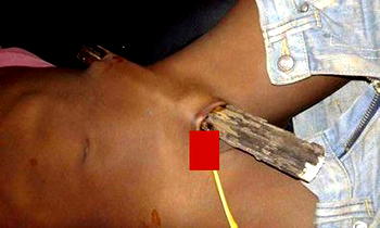 Photos: Man alleged to have been operated on by doctors in Nigerian