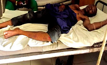 Keke operator, passengers beat Abia traffic warden to stupor
