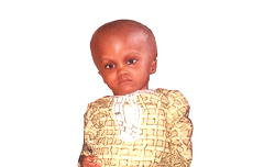 Hydrocephalus: Kehinde seeks N500, 000 for surgery