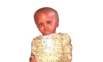 Hydrocephalus: Kehinde seeks N500, 000 for surgery