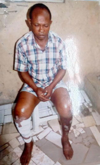 HELP! Samuel, 35, seeks N8m for kidney transplant