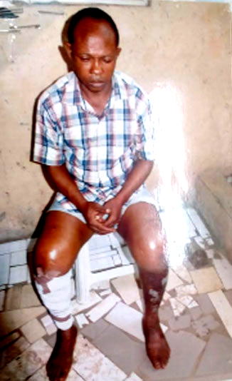 HELP! Samuel, 35, seeks N8m for kidney transplant