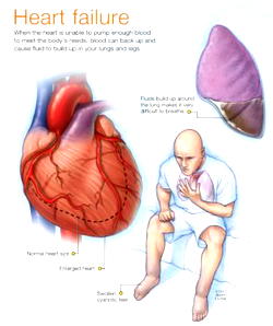 How four cans of energy drink can seriously damage your heart!