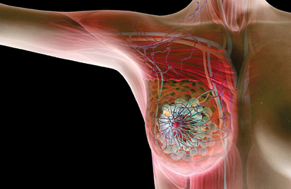 Common causes, signs, prevention tips for breast fungal infection -  Vanguard News