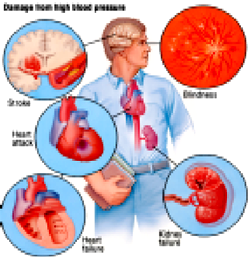 Ogun State govt, Power Oil partner in fight against hypertension