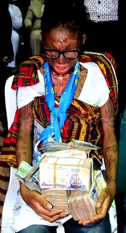 Iginla gives Muslim acid victim N10m, sponsors her surgery