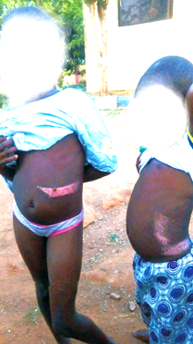 DAD FROM HELL: Our father burnt our stomachs with red hot knife for allegedly stealing fish