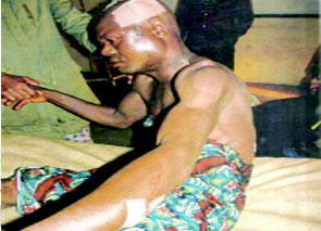 How I survived herdsmen attack – Rice farmer