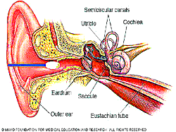 The ear, the cotton bud and the seven signs of trouble