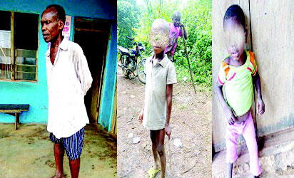 Ekpene Ibiabong: C-River community of skin-and-bone children