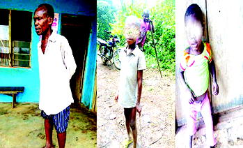 Ekpene Ibiabong: C-River community of skin-and-bone children