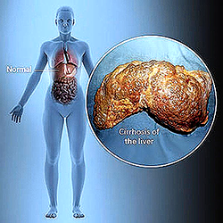 Your liver won’t leave you if you live well