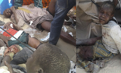 UN dispatches medics, airlifts aid officials injured in accidental airstrike