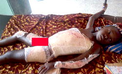 Family of kerosene explosion victim begs Bayelsa, Delta govts for help