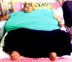 Heaviest woman lifted by crane, lands Mumbai for treatment