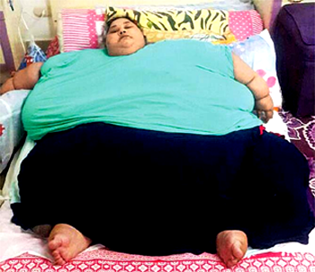 Heaviest woman lifted by crane, lands Mumbai for treatment