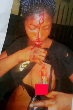 Nursing mum allegedly cuts rival with razor blade