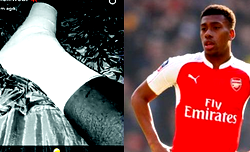 Iwobi reveals FA Cup clash scars