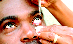 New eye drops melt cataracts