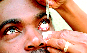 Regular eye tests prevent blindness from glaucoma, says Onakoya