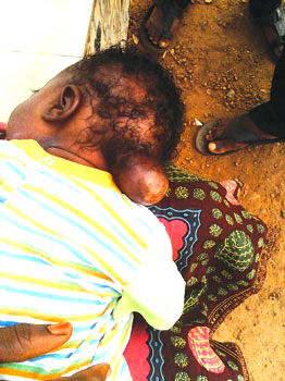 Baby seeks N0.4m to save her sight