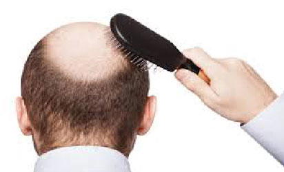 Shorter men more likely to go bald earlier - Vanguard News